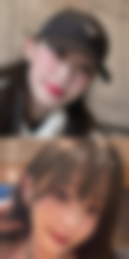 隆胸术成效的影响因素：你不可不知！