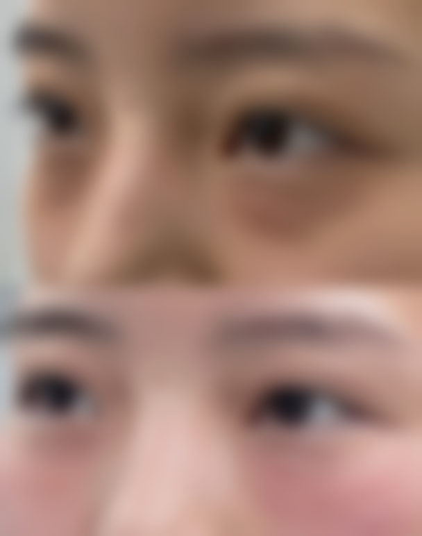 口碑好的长沙整形医院