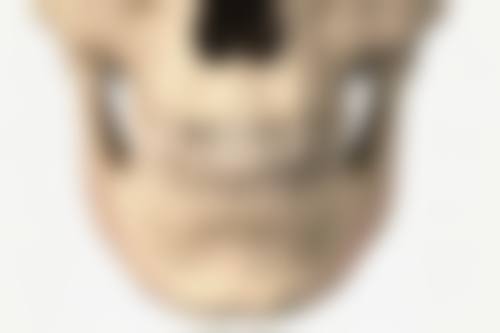 假体破裂或泄漏：隆胸手术的潜在危机