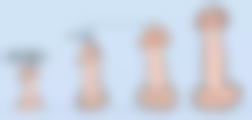 乳房感觉异常：隆胸手术带来的不适