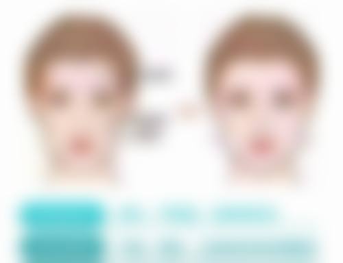 做隆胸手术有什么后遗症？可能有感染、包膜挛缩等，但选正规医院和医生可降低风险！ 