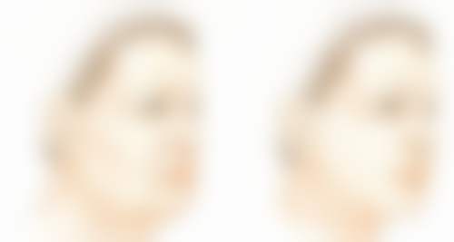 深圳大学总医院整形美容科真实实例与优势