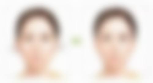 加格达奇做双眼皮哪一家好？韩艺来、黑龙江超龙等医院值得选，有专业团队和贴心服务！ 