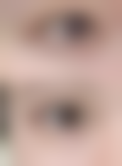 口腔正畸项目特色