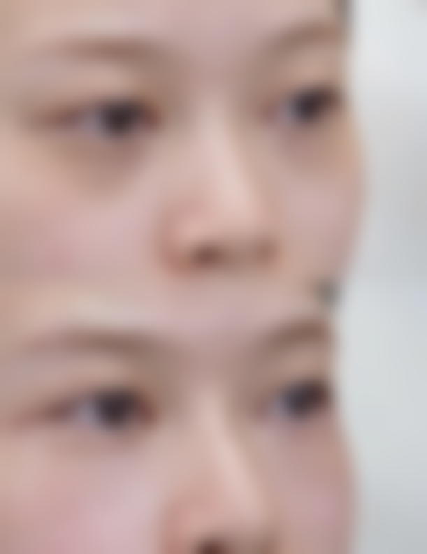 淮安市刘玉医疗美容诊所收费标准