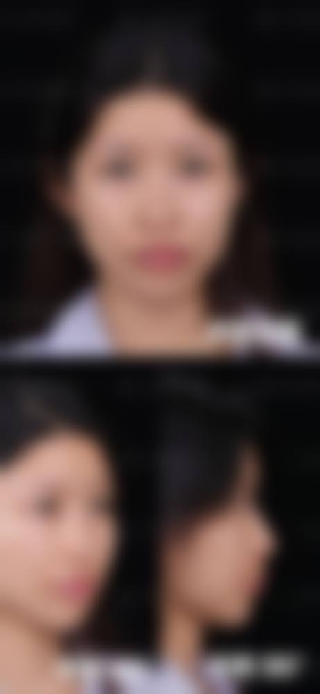 韩国Prima整形外科医院用户评价