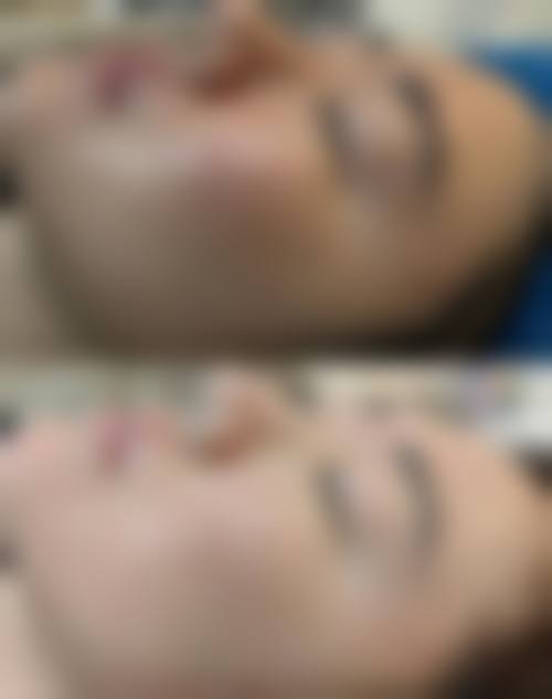 吉林金羽缇整形美容医院用户口碑