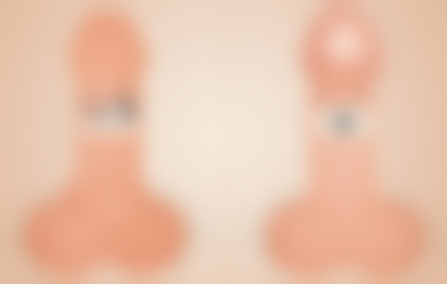 护理方式对疤痕增生消除的影响