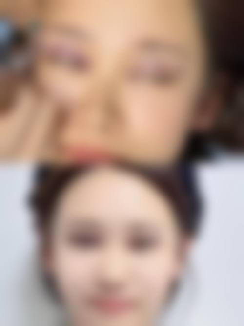 北京清木张曼个人资料简介：揭秘其眼部整形技术优势及北京清木医院良好口碑！ 