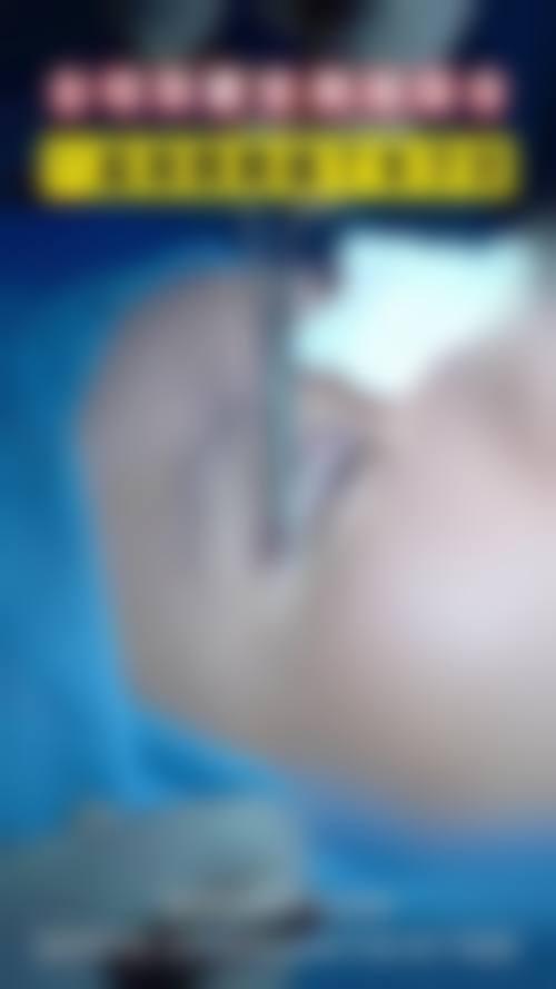 上海艺星郭敬松韩国do脸攻略：郭敬松融合韩技个性化设计，真人案例见证口碑！ 