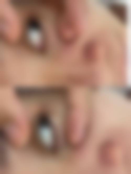 绍兴越城华美整形医疗门诊部用户反馈口碑（3条）