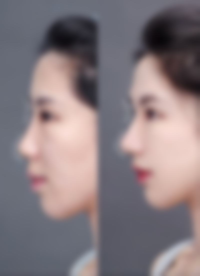 擅长项目多样化