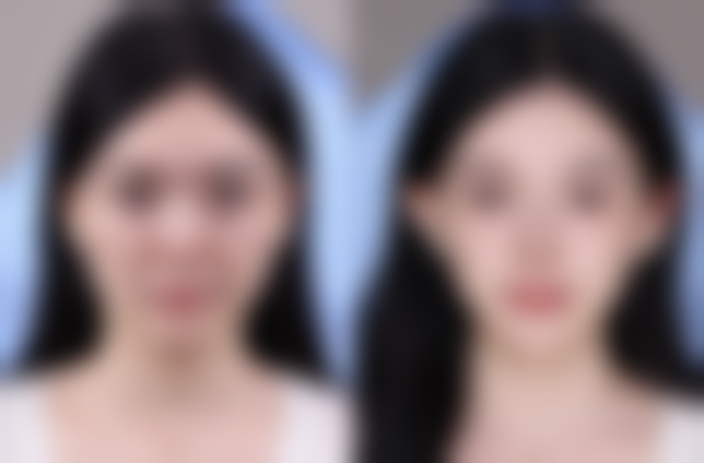 郑州新生整形美容医院特色项目及技术优势