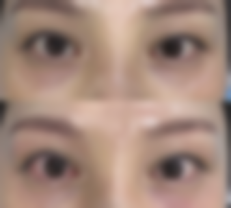 郑州新生整形美容医院真人口碑评价怎么样？