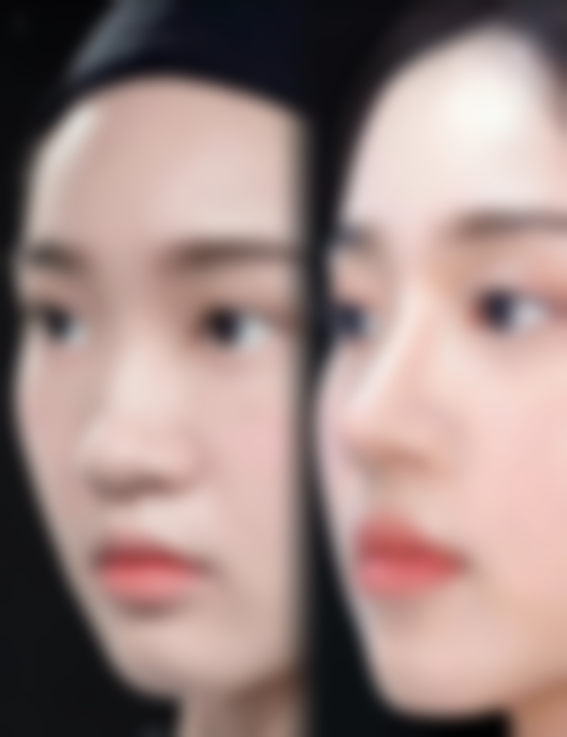 婴儿烫伤疤痕增生多久消除？一般6个月到2年，受面积、深度、体质等因素影响！ 