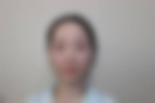 天津南开黄学峰医疗美容门诊部收费参考：10+核心项目透明化展示