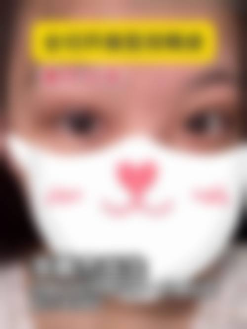 怎么把眼睛睡成双眼皮？睡觉难成双眼皮，日本眼膜或可行，6D手术更持久自然！ 