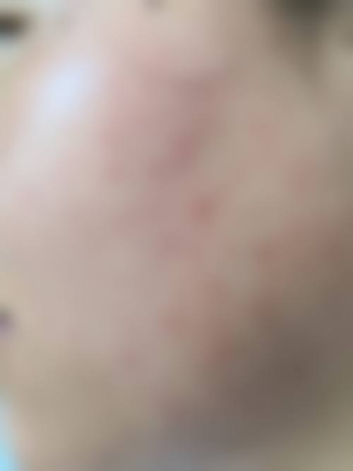 深圳睦心整形医院医院擅长什么？