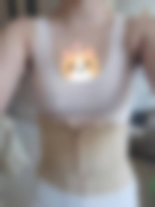 影响自体脂肪隆胸持久性的关键因素——脂肪存活率