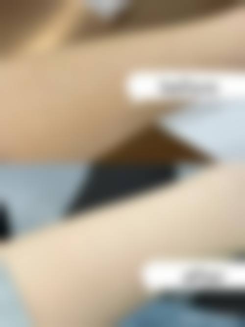 王灵娟医生擅长项目