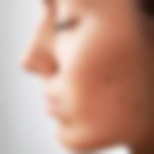 深圳睦心整形医院如何预约？