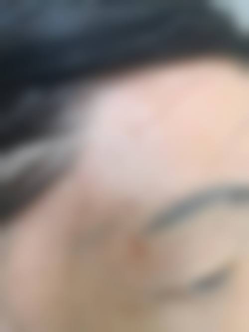 深圳睦心整形医院收费贵吗？