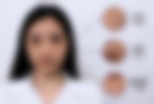 与其他祛斑项目对比