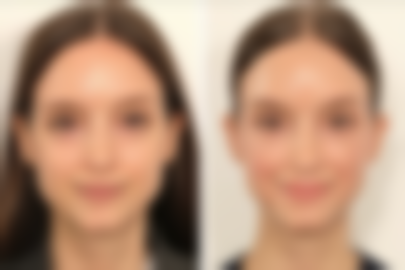 深圳睦心整形医院环境和服务如何？