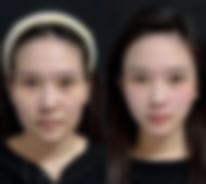 成都市西区医院医疗美容科价格表，含热门项目价格区间、优质诊疗服务及良好口碑评价！ 