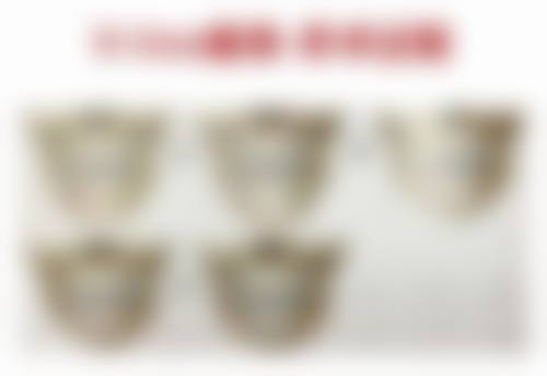 热玛吉手术成效