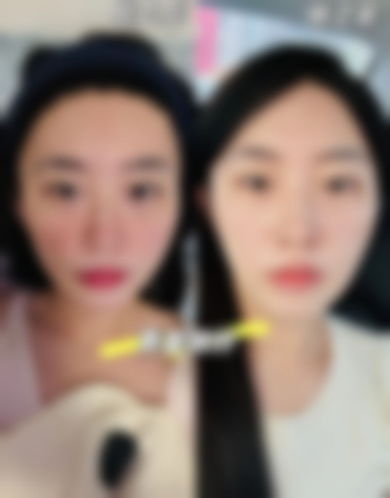 热玛吉收费价格