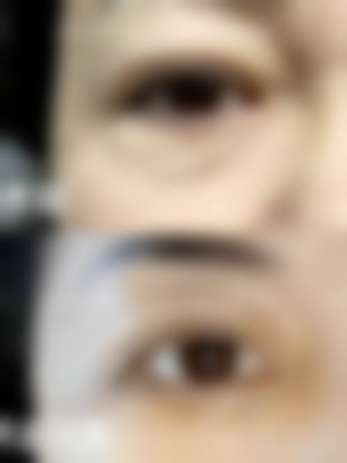 修复性治疗方法