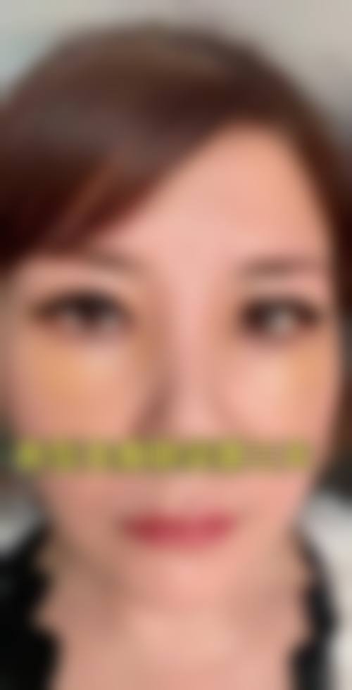 合肥美泽整形医院补牙材料好吗