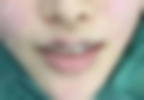 南京施尔美整形医院：鼻整形修复示范基地