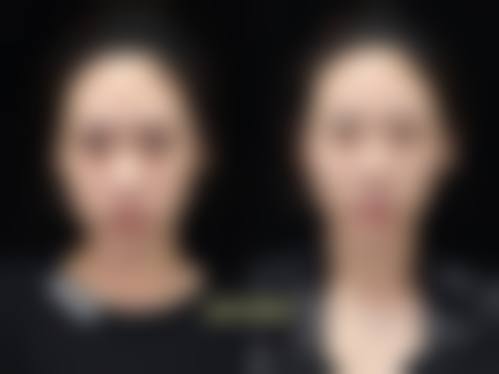 南京美莱整形医院：眼部与胸部整形佼佼者