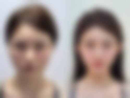 谢宏彬怎么挂号？多种方式全揭秘，出诊时间、拉皮价格也一并奉上！ 