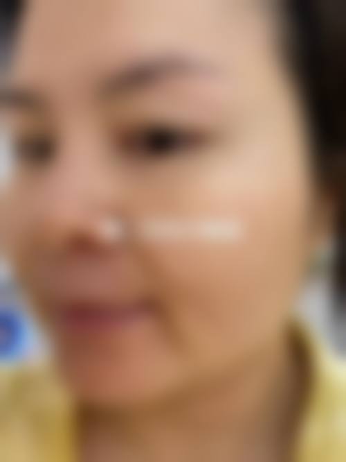 合肥美泽整形医院怎么样？开展项目多，割双眼皮自然，补牙材料好值得一去！ 