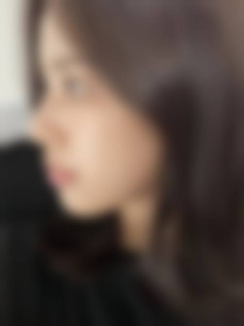 隆鼻后鼻头多久恢复？一般1 - 3个月，恢复时间受手术方式、个人体质和术后护理影响