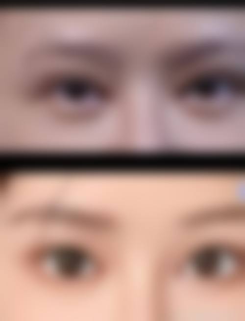 北京常冬青眼睛修复价格与预约攻略大揭秘