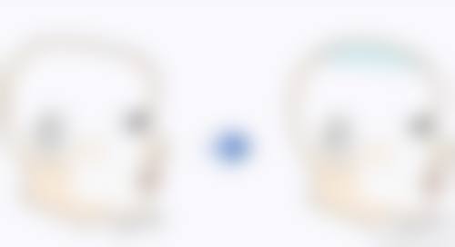 私密紧缩项目详情