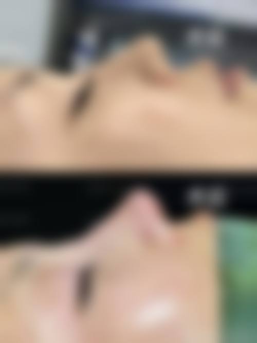 黄其然医生收费贵吗？