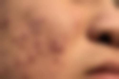 王凯丽医生技术优势