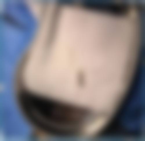 艺星：连锁品牌优势，专科深度精研