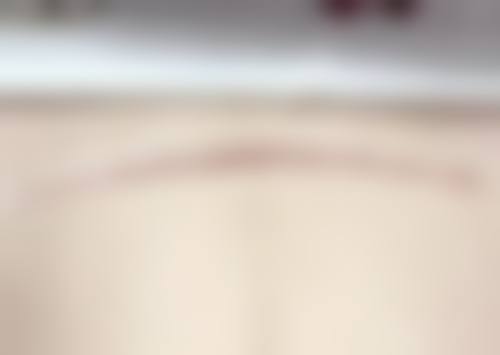 三、术后护理对修复时间有何影响？