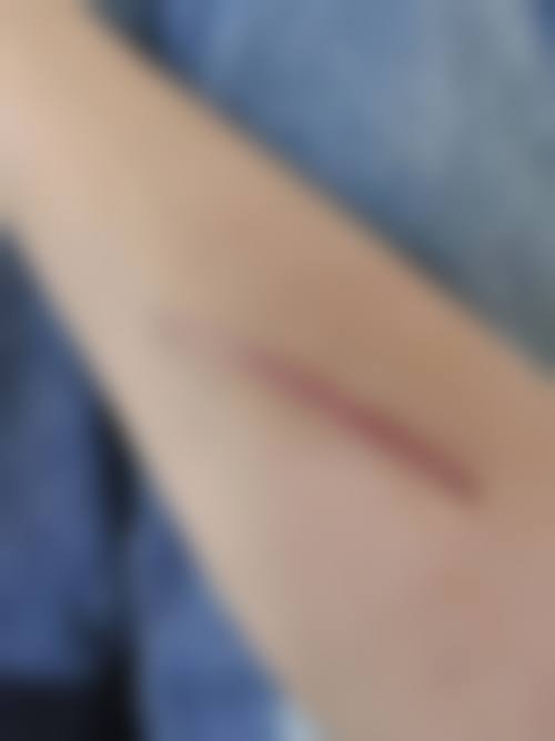 沈阳伊容医疗美容诊所患者口碑：真实评价+体验细节