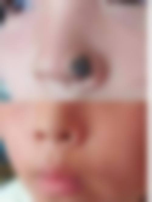 沈阳伊容医疗美容诊所收费参考：10+核心项目透明化展示