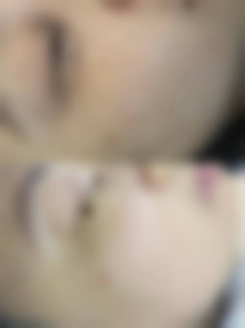 王凯丽医生口碑评价及真人实例