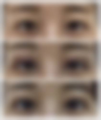 丹东晶馨整形美容医院项目清单