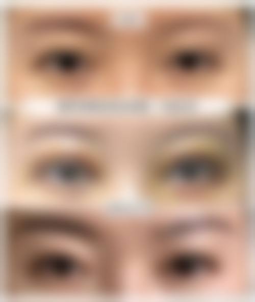 四、合肥艾雅医疗美容开展了哪些项目？