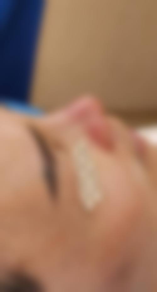 八、刘金超医生的手术成效如何保护？